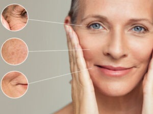 radiofrequenza per il viso lugano