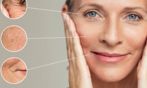 radiofrequenza lugano radiofrequenza per il viso lugano