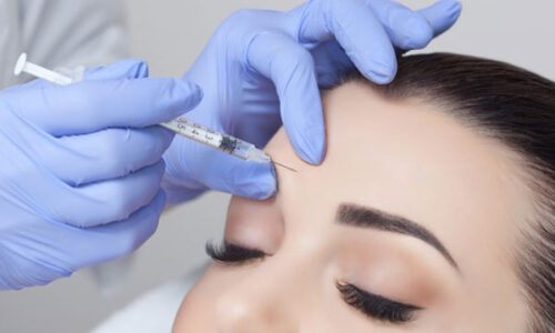 Punture intradermiche di acido jaluronico Punture intradermiche di acido jaluronico
