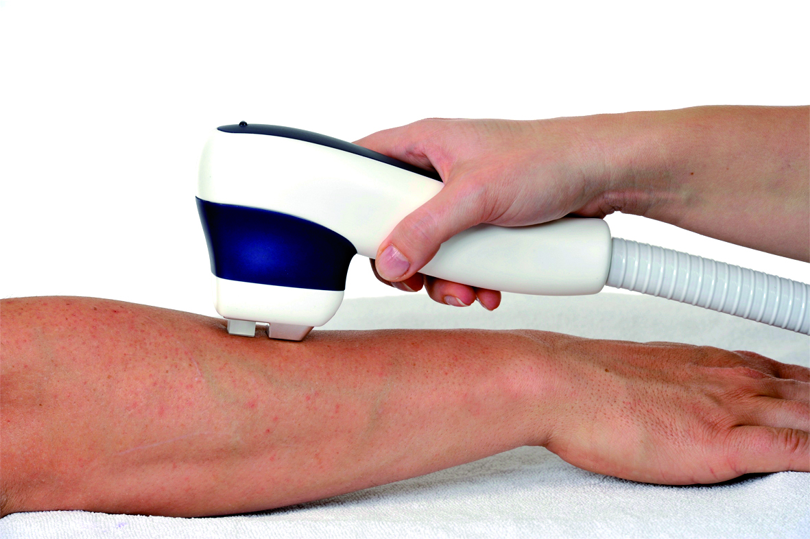 bracciox Trattamento estetico su braccio con apparecchio laser